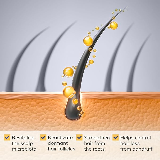 Seborrheic Dermatitis Folliculitis Dandruff Shampoo - Anti Fungal Medicated Shampoo for Healthy Scalp with Selenium Sulfide & Botanical Extracts - Flakes Itchy and Oily Scalp Relief Stop Hair Loss