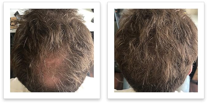 FEBRON Hair Fibers For Thinning Hair For Women & Men Hair Loss Concealer Hair Powder Volumizing Based 100% Undetectable & Natural - Bald Spots Filler (30 Gram, Light COOL Brown)