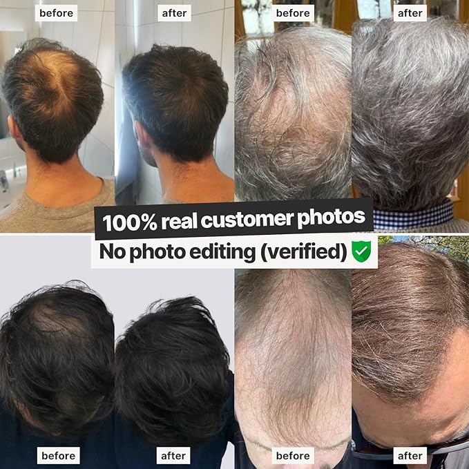 IMPERIO Hair Building Fibers for Thinning Hair - 26g Premium Hair Fibers for Women & Men in Hairdresser Quality - Hair thickening in less than 20 seconds (Light Blonde)