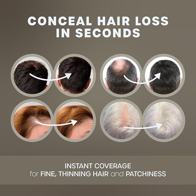 KAAL Hair Fiber for Thinning Hair, Instantly Transforms Your Hair Loss, User-Friendly Styling Powder for Men & Women, Suitable for All Hair Types, Natural Looking, Long Lasting, 0.97 oz, Gray