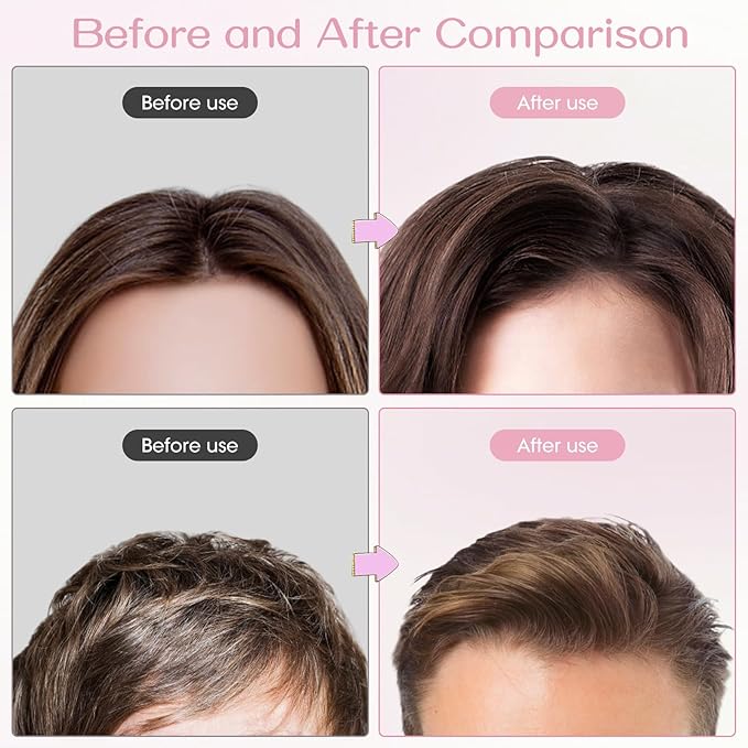 Volumizing Hair Clips for Women 2PCS, Hair Volume Clip Styling Tools Volumizing Comb for Fluffy Bangs Clips for Root Lift, Root Booster Clips