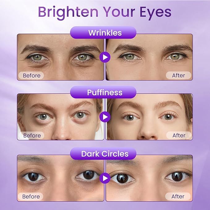 Doracome Retinol Eye Cream for Dark Circles and Puffiness, Hydrating Under Eye Cream for Dark Circles, Anti Aging Dark Circle Eye Cream for Fine Lines, Wrinkles, Firming Eye Contour, 1.06 oz