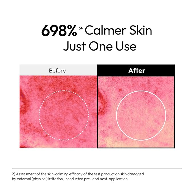 LAYERLAB Barrier Boost Serum with 5% Panthenol 4% Niacinamide, Soothing Korean Skincare for Sensitive Skin with Nano Ceramide Volcanic Water to Support Moisture Barrier Deep Hydration 30ml 1.01 fl.oz.