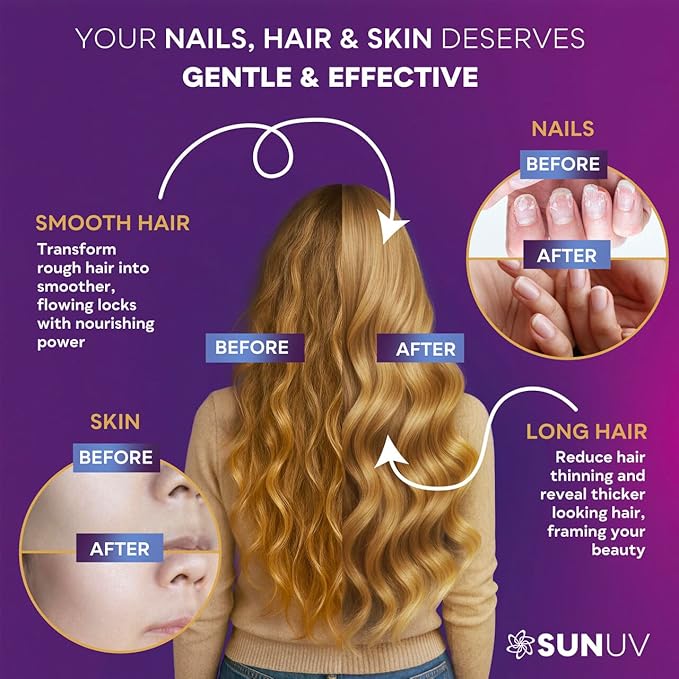 SUNUV Biotin 10,000mcg | Collagen | Keratin - 80,000mcg Hair Growth Vitamins for Women & Men,Skin & Nails Support - Hyaluronic Acid & Vitamins B1,B2,B3,B5,B6,B9,B12 -Made in USA-90 Capsules