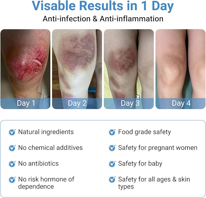 LMNOOP® Wound Care Ointment - Fast Healing Wound Cream, Maximum Repair for All Ages, Wound Healing Ointment for Deep/Open/Surgical Wounds, Bedsores, Diabetic Wounds, Ulcers, Burns, Cuts