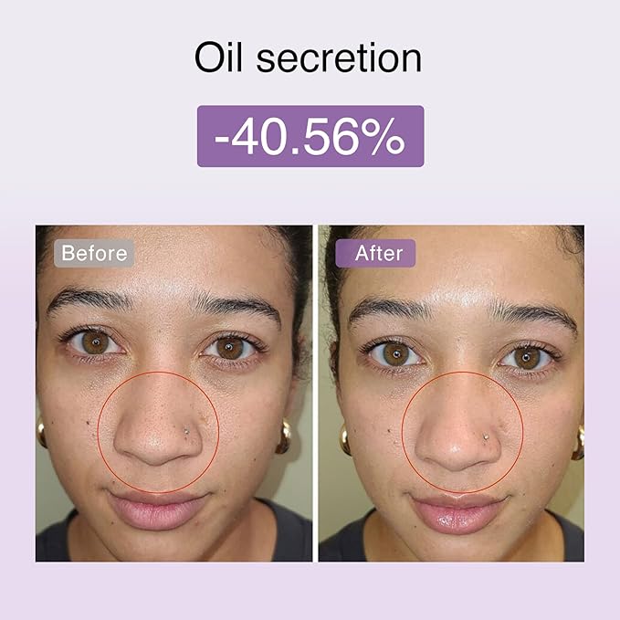 DermRays M1 4-in-1 Facial Toning Tool with Multi-Leading Tech for a Visibly Radiant & Youthful Appearance