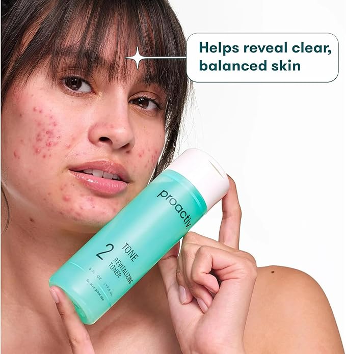 Proactiv Hydrating Facial Toner for Sensitive Skin - Alcohol Free Toner for Face Care - Pore Tightening Glycolic Acid and Witch Hazel Formula - Acne Toner to Balance Skin and Remove Impurities, 4 oz.