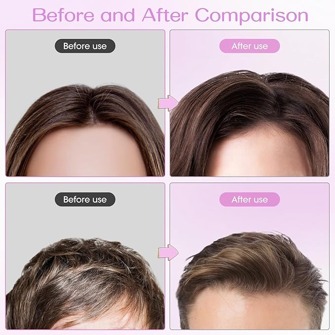 Volumizing Hair Clips for Women 2PCS, Hair Volume Clip Styling Tools Volumizing Comb for Fluffy Bangs Clips for Root Lift, Root Booster Clips