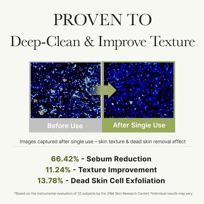 ARENCIA Salicylic Acid, Green Tea + LHA Deep Pore Rice Cake Cleanser – Deep Pore Cleansing, Acne Face Wash, Blackhead Remover, 5.07 fl oz