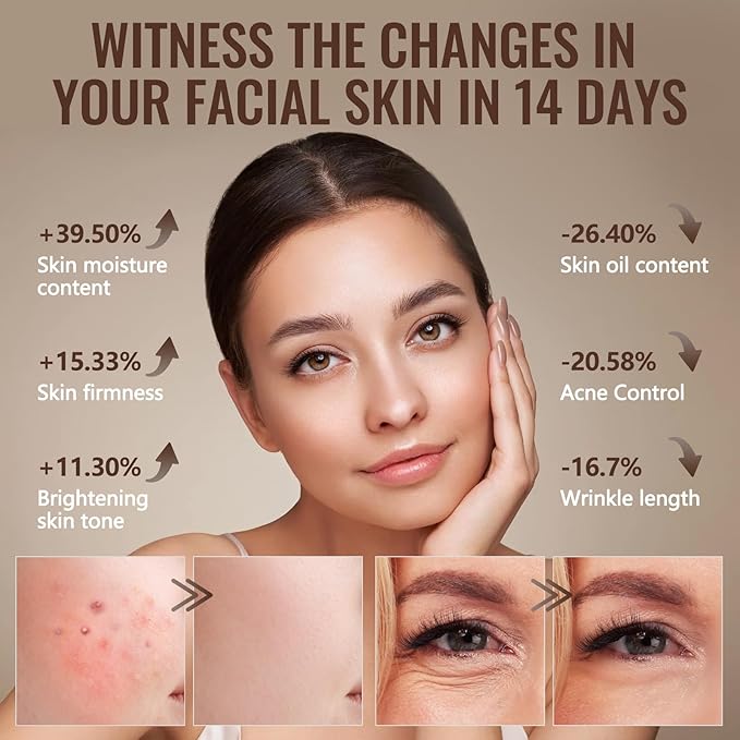 Red Light Therapy Mask for Face,Valentine Gifts for Her Him,4 Modes Acne Removal Wrinkles&Redness Anti-Aging,2000mAh Rechargeable,Wirless Remote,Infrared Photon Facial Mask for Travel Yoga