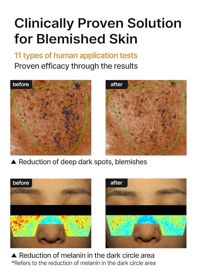 celimax Pore+Dark Spot Brightening Cream | with Niacinamide, Tranexamic Acid, TXA Cream, Pore Minimizer, Non-Irritating, Hydrating, For Sensitive Skin, Valentine's Gift, 35ml