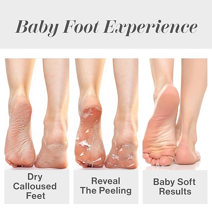 Baby Foot Original Exfoliation Foot Peel - For Rough Cracked, Dry Feet, Dead Skin Removal - Foot Peeling Mask for Baby Soft Feet - Spa Experience at Home & Gift Ideas - Lavender Scented