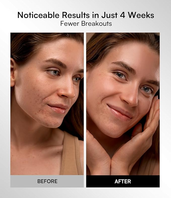 INIA Red Light Therapy Mask for Face – 4 Light Modes with 850nm NIR, Red & Blue LED Light Therapy, 2600mAh Rechargeable LED Face Mask for Radiant Glow at Home, Black