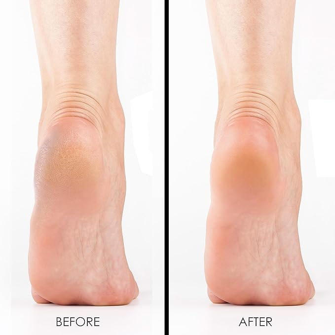 Double Pumice Pack, Bundle Includes Mint Scented Callus Remover, 2 Pumice Stones for Feet, and 4 Pairs of Gloves, Salon Grade Foot Care, Home Manicure and Pedicure Kit