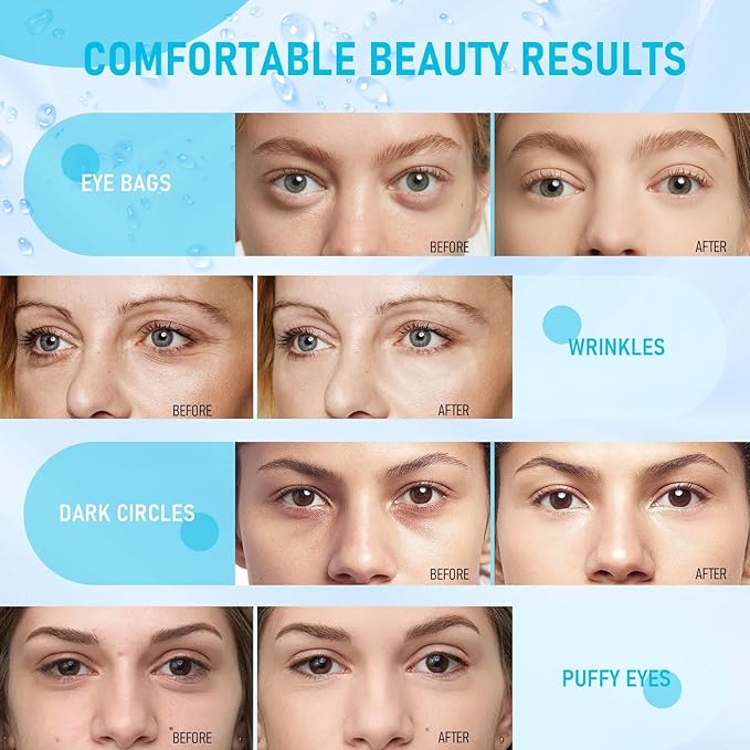 LAVONE Under Eye Patches-30 Pairs Hydrating & Anti-aging Eye Mask Skin Care for Dark Circles and Puffiness,Reduce Wrinkles,Eye Bags and Fine Lines,Eye Masks for Women and Man