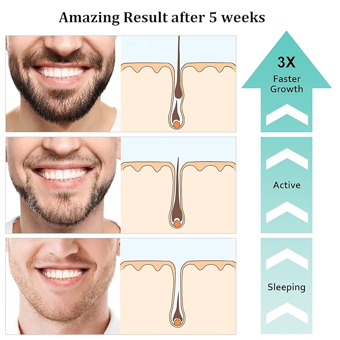 Beard Growth Kit, Upgraded Beard Growth Oil (2Oz) w/3 X Thickening Biotin & Castor Oil for Spot/Patchy Beard, Achieve Fuller, Thicker & Healthier Beards, Valentines Day Gifts for Him Boyfriend Husband