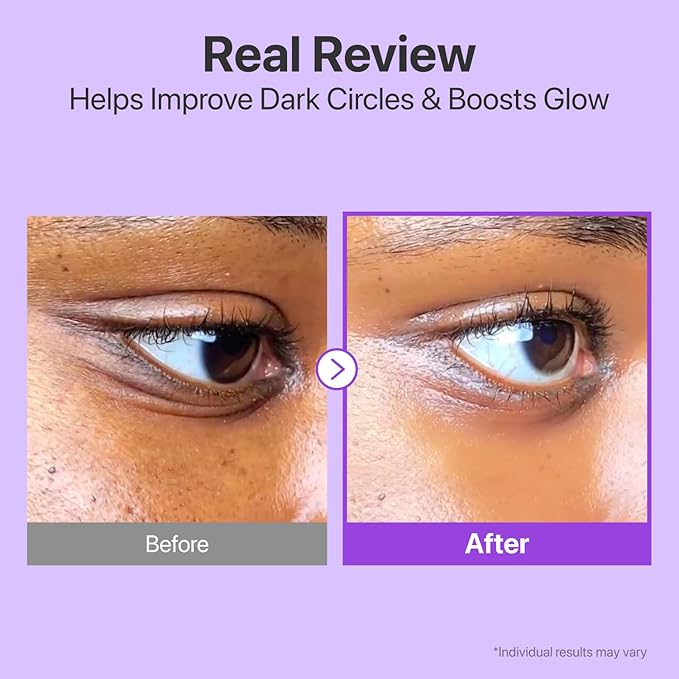 numbuzin No.9 NAD+ Retinol Eye Cream, Depuffing & Firming Eye Serum for Dark Circles, Wrinkles & Fine Lines, Peptides & Niacinamide for Glow & Undereye Radiance, Stocking Stuffers 0.33 fl oz