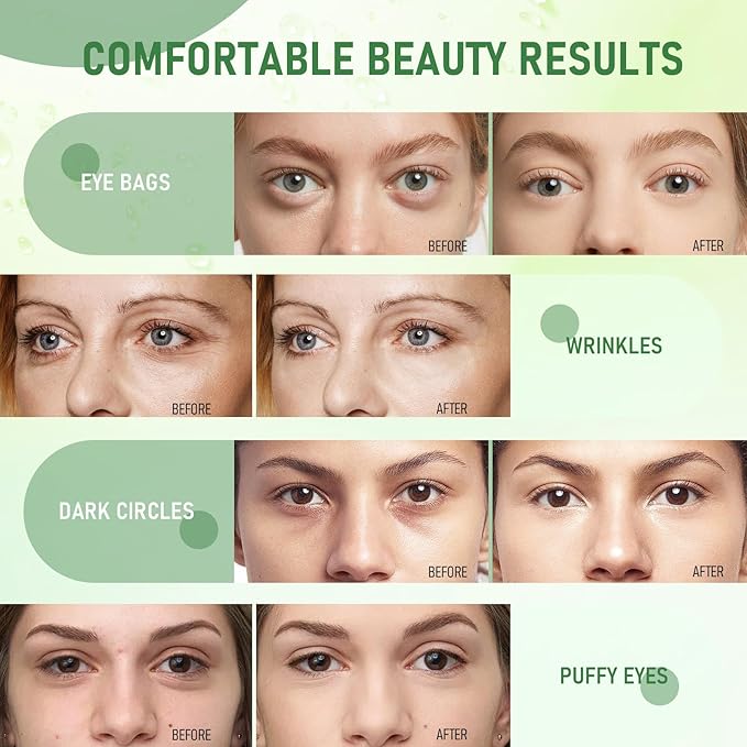 LAVONE Eye Mask - 30 Pairs Aloe Under Eye Patches Skin Care Products - Eye Masks Skincare for Dark Circles and Puffiness, Reduce Wrinkles, Eye Bags and Fine Lines, for Women and Man