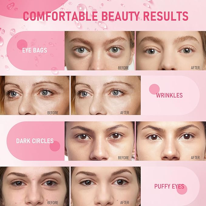 LAVONE Eye Mask - 15 Pairs Rose Under Eye Patches Skin Care Products - Eye Masks Skincare for Dark Circles and Puffiness, Reduce Wrinkles, Eye Bags and Fine Lines, for Women and Man, with Hair Clips