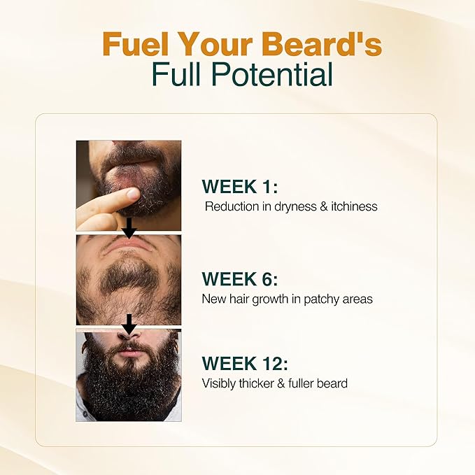 NOURISH MANTRA - Advanced Beard Growth Oil Serum | Made with Redensyl, Capilia Longa, Argan Oil, Vitamin E and Jojoba Oil for Fuller, Thicker & Healthier Beard Growth | Beard Oil Serum For Men | 30 ml