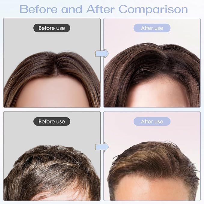 Volumizing Hair Clips for Women 2PCS, Hair Volume Clip Styling Tools Volumizing Comb for Fluffy Bangs Clips for Root Lift, Root Booster Clips