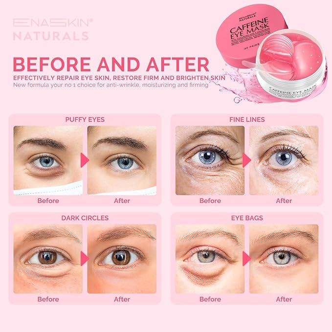Enaskin Naturals Under Eye Patches for Dark Circles: 60 Pairs Caffeine Eye Gels Mask - Reduce Wrinkles Puffy & Bags - Skin Treatment Pads - Anti Aging Moisturizer For Women (Pink 2 Pack)