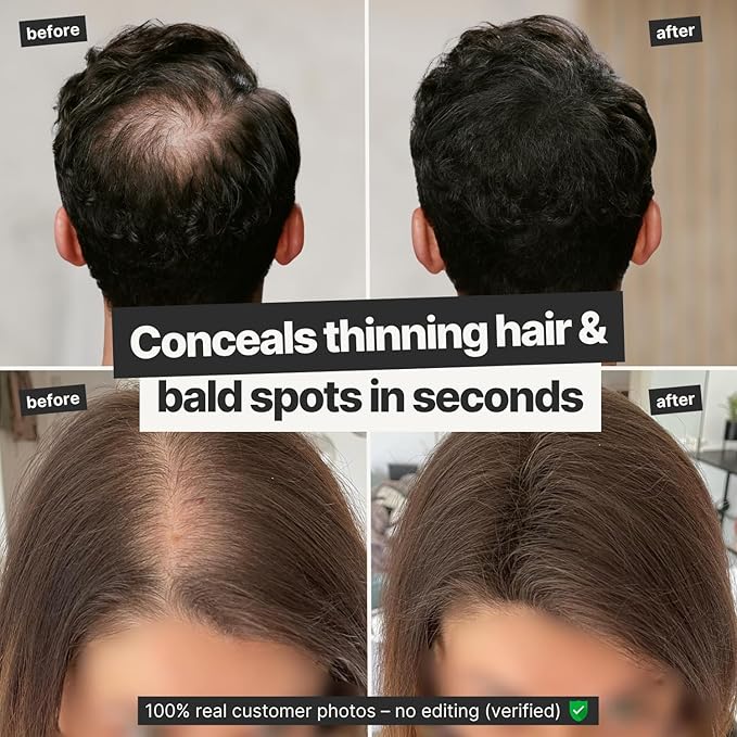 IMPERIO Hair Building Fibers for Thinning Hair - 26g Premium Hair Fibers for Women & Men in Hairdresser Quality - Hair thickening in less than 20 seconds (Dark Blonde)