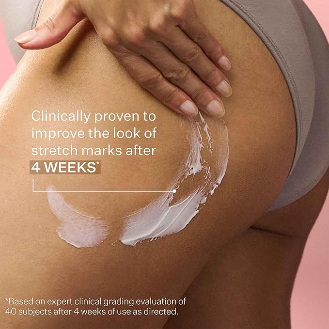 StriVectin SD Advanced Plus Intensive Moisturizer for Wrinkles and Stretchmarks, For Face and Body, Collagen Boosting with Peptides and Hyaluronic Acid, 4 Fl Oz (Pack of 1)