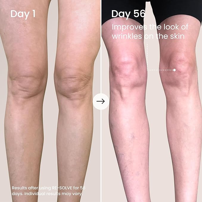 MAËLYS RE-SOLVE Age-Defying Body Serum - Anti-Aging Body Serum With Hyaluronic Acid -Targets The Appearance of Fine Lines, Wrinkles & Loose Skin