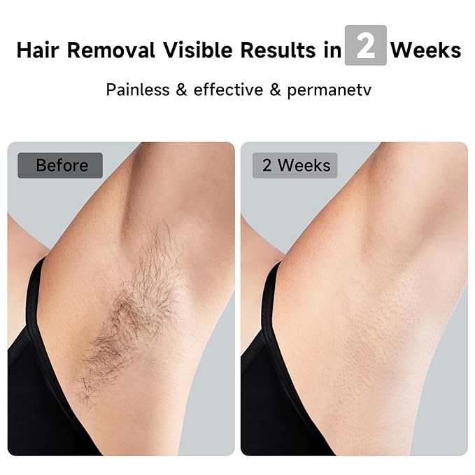 JOVS Laser Hair Removal, 37°F Painless Hair Removal Device with Sapphire Ice-Cooling, 3 in 1 Hair Removal & Skin Rejuvenation for Women and Men, 8 Modes Skin Care for Whole Body, Touch Screen, White