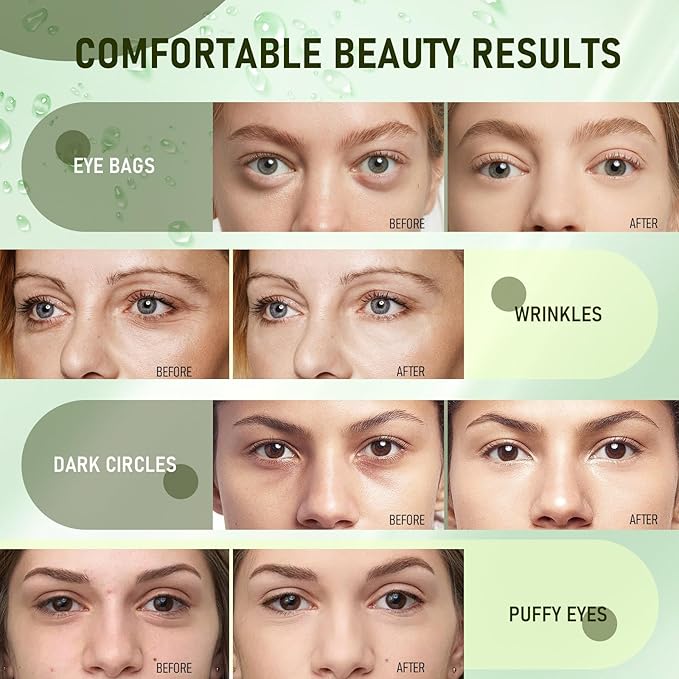 LAVONE Eye Mask - 30 Pairs Avocado Under Eye Patches Skin Care Products - Eye Masks Skincare for Dark Circles and Puffiness, Reduce Wrinkles, Eye Bags and Fine Lines, for Women and Man