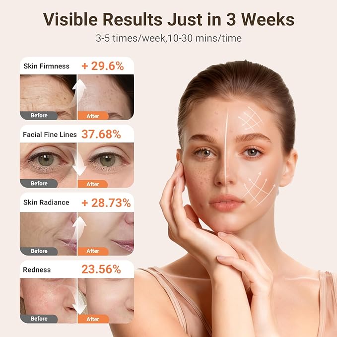 Red Light Therapy Mask for Face, 2026 LED Face Mask Light Therapy, 4 Modes with Red/Blue/infrared/Dual Red & Blue Lights for Reduce Acne, Anti-Aging and Blemish Repair, Full Face Coverage, Lightweight