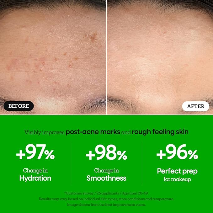 Nature Republic The First Peptide Boosting Serum – Niacinamide, Adenosine, Hydrating & Firming Facial Serum, for Uneven Skin Tone, Korean Skincare, 150ml / 5.07 fl oz