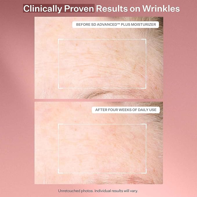 StriVectin SD Advanced Plus Intensive Moisturizer for Wrinkles and Stretchmarks, For Face and Body, Collagen Boosting with Peptides and Hyaluronic Acid, 4 Fl Oz (Pack of 1)