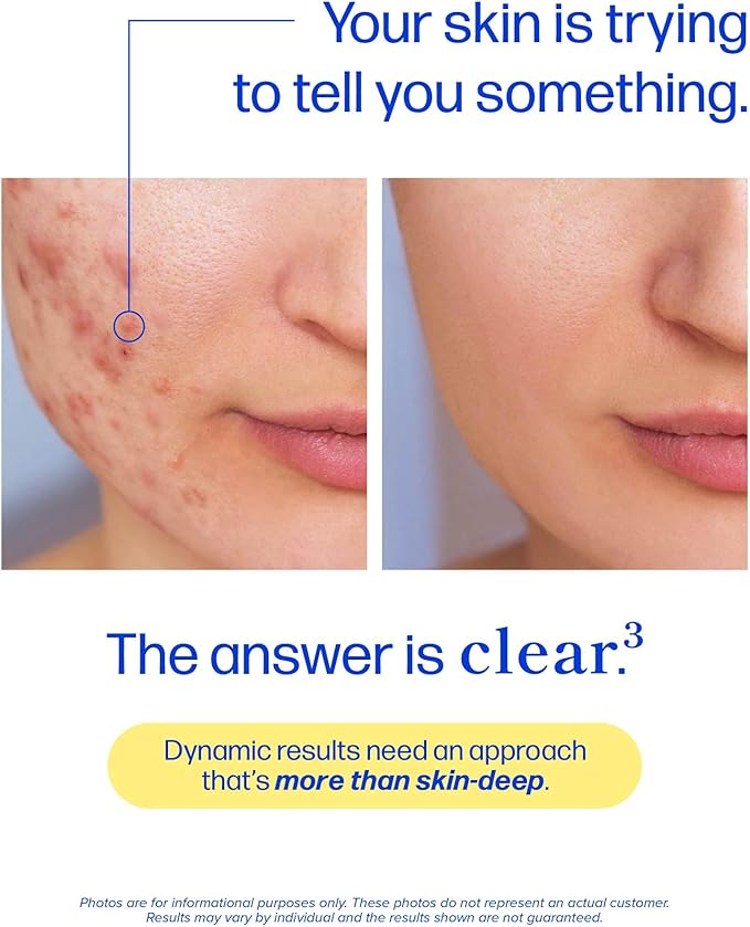 Clear Skin Supplement with Zinc, DIM & Probiotics | 3-in-1 Balance, Glow & Health Skin Support | Triple Action Hyaluronic Acid, Niaciminide & Vitamins for Hormone, Complexion & Gut Support | 60 Ct