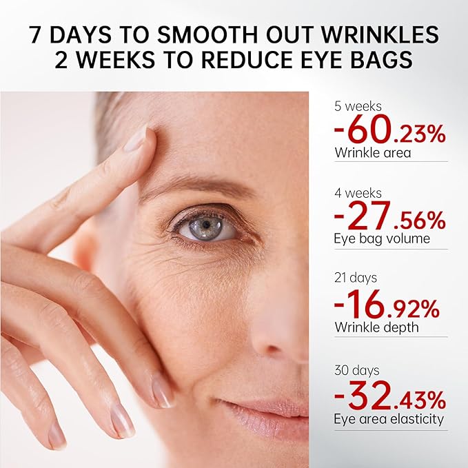 Retinol & Caffeine Eye Serum -360° Massage Roller for Puffiness,Eyebag Remover,Wrinkle Filler,Under Eye Cream For Dark Circles 0.54fl.oz (Pack of 1)