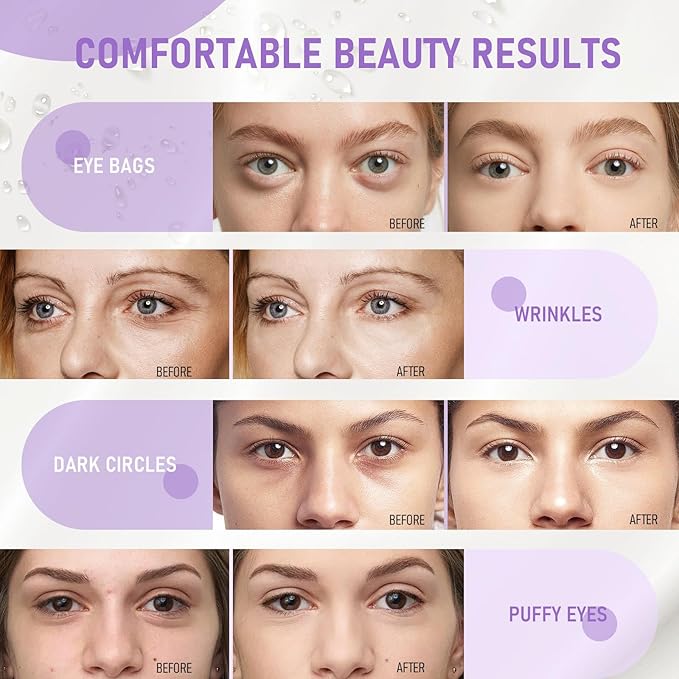 LAVONE Eye Mask - 30 Pairs Grape Seeds Under Eye Patches Skin Care Products - Eye Masks Skincare for Dark Circles and Puffiness, Reduce Wrinkles, Eye Bags and Fine Lines, for Women and Man