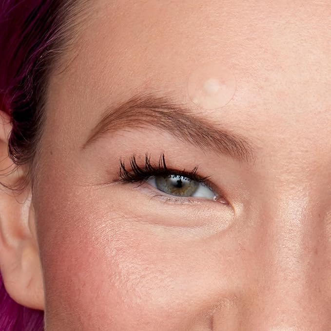 PEACE OUT Acne Day Dot Sheer Hydrocolloid Pimple Patches, Invisible Acne Spot Patches with Encapsulated Salicylic Acid, Retinol, and Aloe Vera, 40 Dots