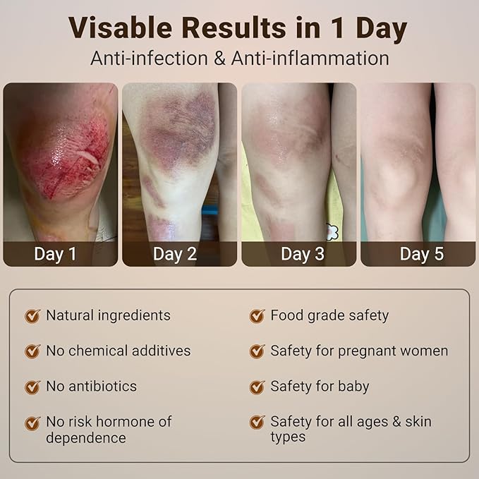 LMNOOP® Wound Care Cream, Skin Healing & Repair Ointment for Infection Ulcers Cuts Scrapes Burns Bites Surgical and Various Wounds, Pressure Treatment Products & Bed Sore Cream