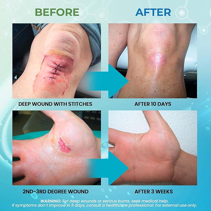 MediQuick Hypochlorous Acid Spray Mist, Antiseptic Spray for Skin & Wound Care, No-Sting, 4 oz