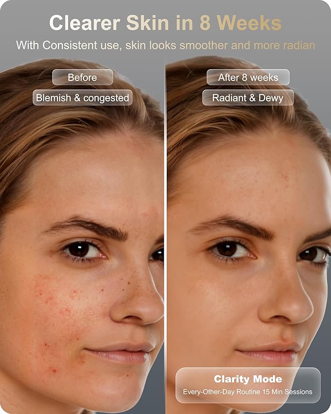 Lumefu Nimbus FDA-Cleared 3D Red Light Therapy Mask For Face 2026, Valentines Day Gift Anti-Aging & Acne Full Face Coverage 3 Treatment Modes 850nm NIR & Blue LED, Cordless Portable Home Use & Travel