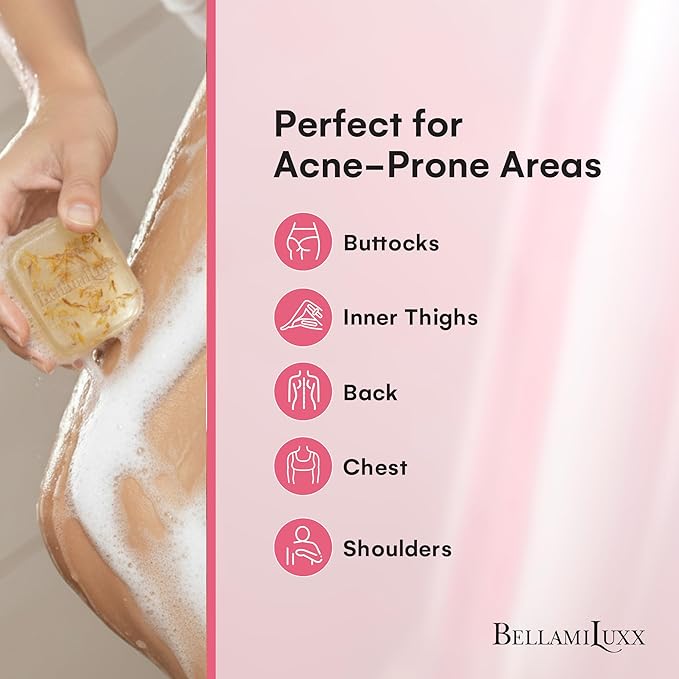 BellamiLuxx Butt Acne Treatment Set: Acne Soap Bar + Butt Treatment Lotion for Breakouts on Buttocks, Thighs, Back, Chest & Ingrown-Prone & Folliculitis-Prone Skin – Helps Reduce Body Breakouts