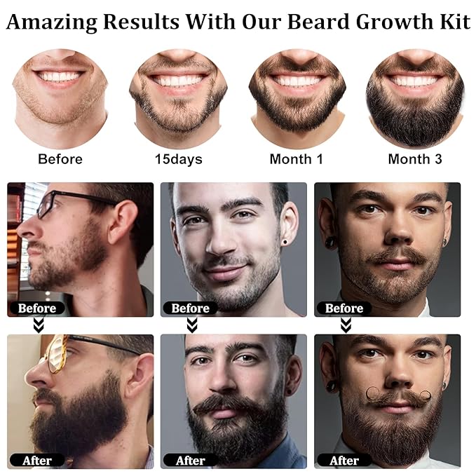 Beard Growth Kit, Upgraded Beard Growth Oil (2Oz) w/3 X Thickening Biotin & Castor Oil for Spot/Patchy Beard, Achieve Fuller, Thicker & Healthier Beards, Valentines Day Gifts for Him Boyfriend Husband
