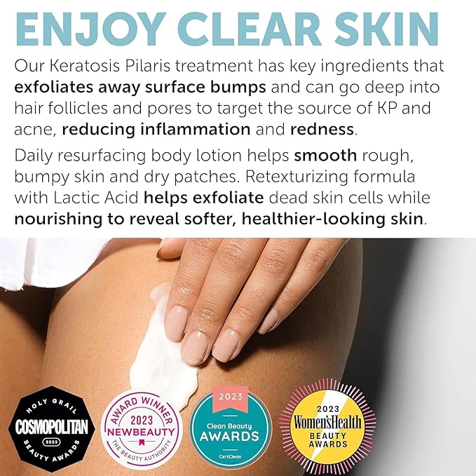 Keratosis Pilaris Treatment | Keratosis Pilaris Lotion with 10% AHA | Gentle Exfoliation For Strawberry Legs, KP & Ingrown Hairs | Smooth & Hydrating Body Lotion For Redness, Dry, Rough And Flaky Skin