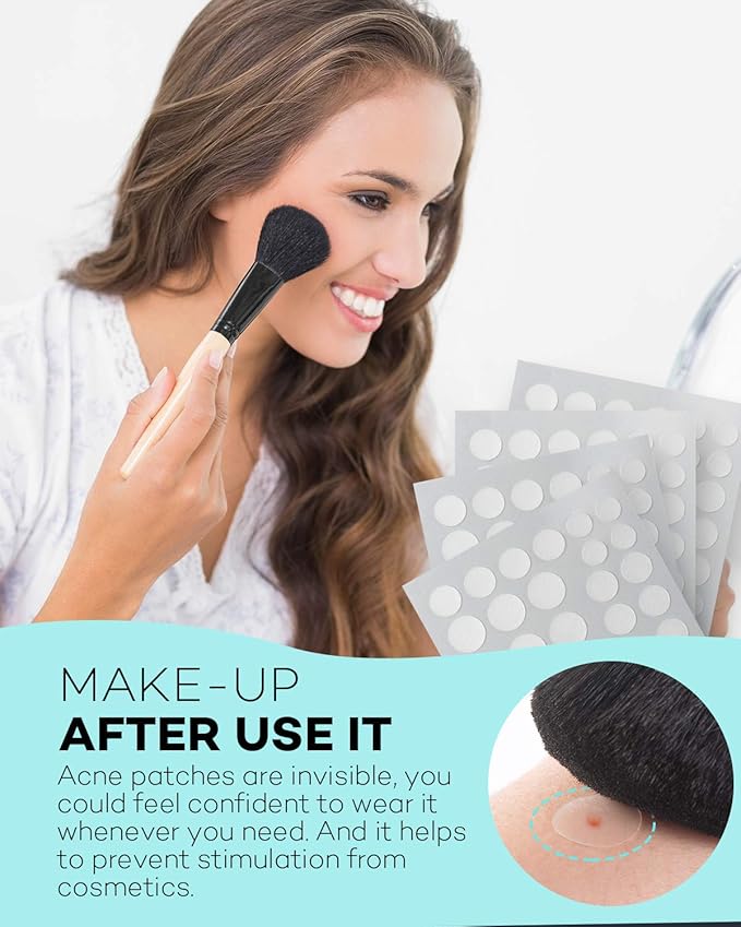 TKTK Pimple Patch Acne Patch, 4 Sizes 280 Patches Acne Absorbing Cover Patch, Hydrocolloid Invisible Acne Patches For Face Zit Patch Acne Dots Tea Tree, Calendula Oil - 2 Pack