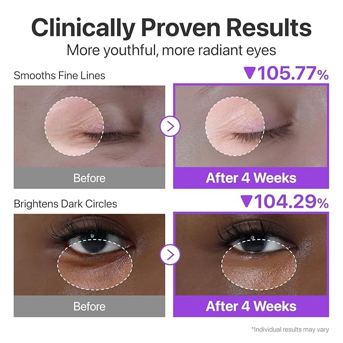 numbuzin No.9 NAD+ Retinol Eye Cream, Depuffing & Firming Eye Serum for Dark Circles, Wrinkles & Fine Lines, Peptides & Niacinamide for Glow & Undereye Radiance, Stocking Stuffers 0.33 fl oz