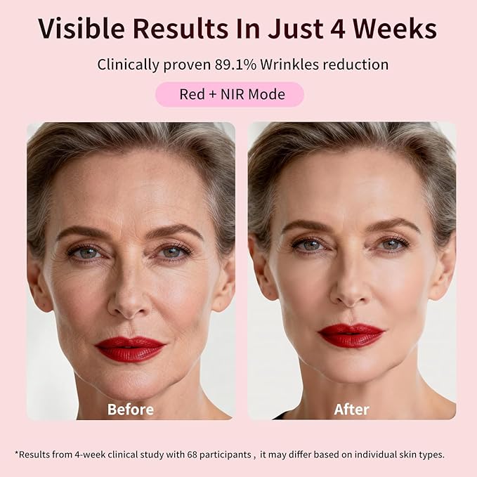 FDA-Cleared Red Light Therapy Mask for Face – 3 Modes for Acne and Wrinkles, 5 Intensity Levels，850nm Infrared Led Light Therapy Device, Pink