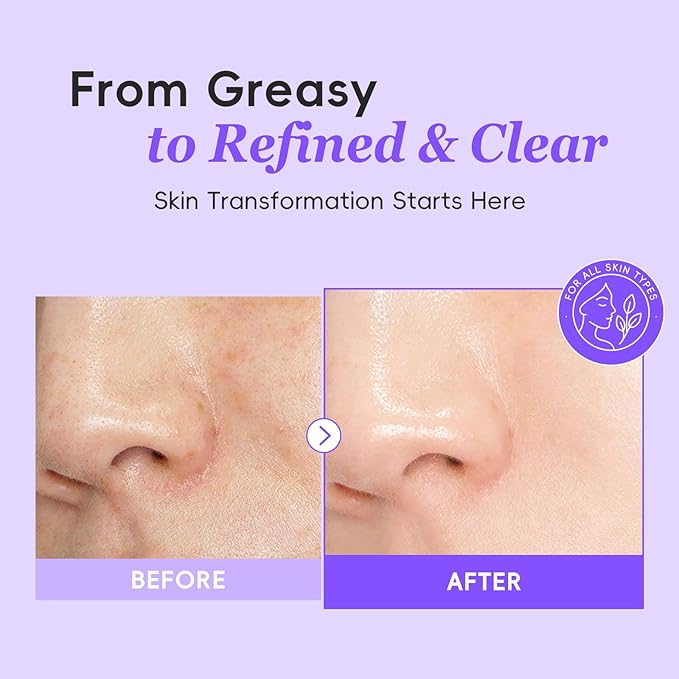 Korean Style Skin Care Set for Dry Sensitive Skin, Natural Skincare Kit with Hyaluronic Acid & 5-Ceramide, Birthday Gifts for Women | Hydrating | Repairing | Gentle | Gift Sets