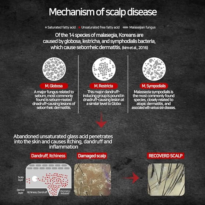 ZENOTRI Biotin and Zinc Pyrithione Shampoo - Combats Itching, Dandruff, Seborrhoeic Dermatitis & Sebum Buildup | Scalp Care Solution | 300ml 10 oz