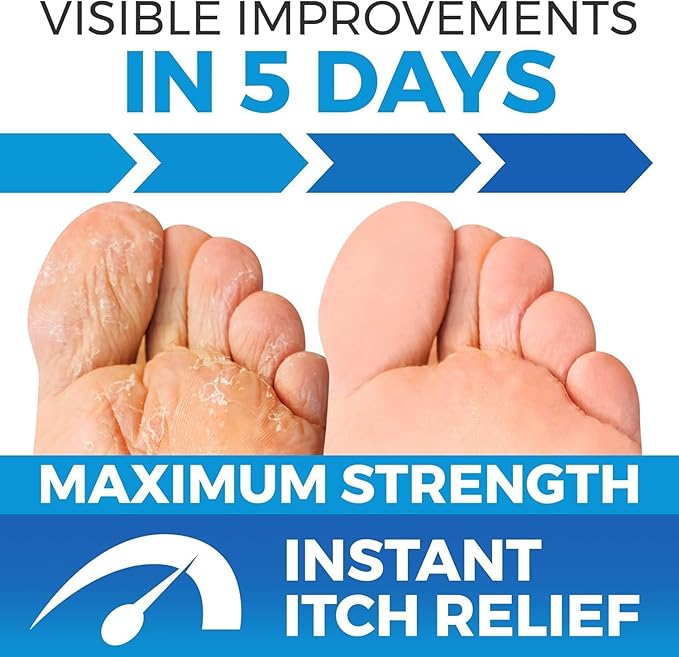 Imperial Feet Antifungal Skin Cream - Athletes Foot Treatment - Jock Itch Cream Extra Strength - Ringworm Treatment for Humans - Used by Professionals - XL 75 ML